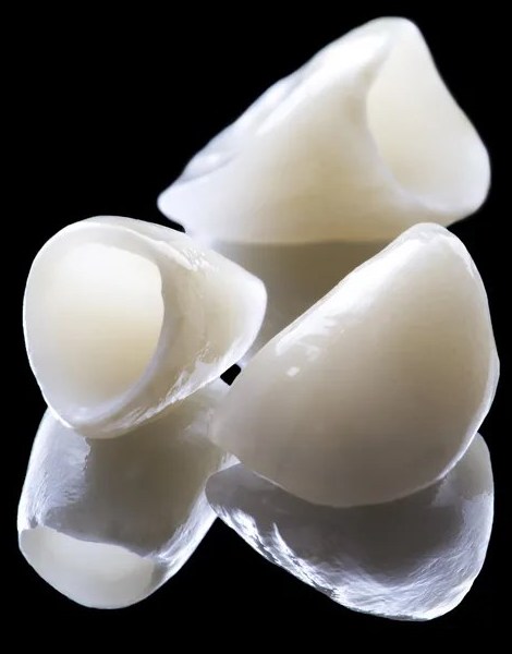 Протезирование зубов современными коронками из диоксида циркония